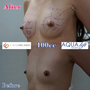 aqua_eone3
