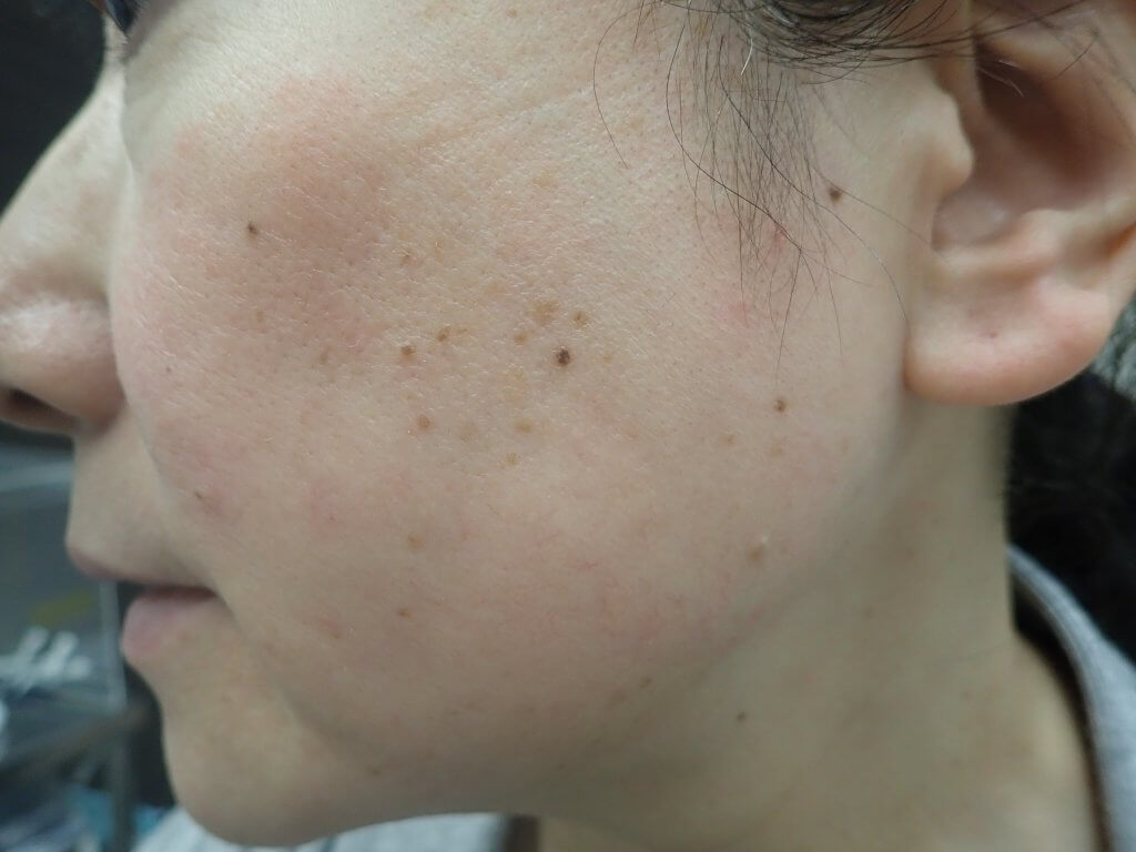 頭皮 皮膚 科 東京 1940